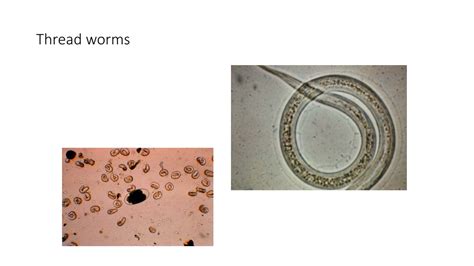  Udder Worms: En Överraskande Försvinnande Akrobat!