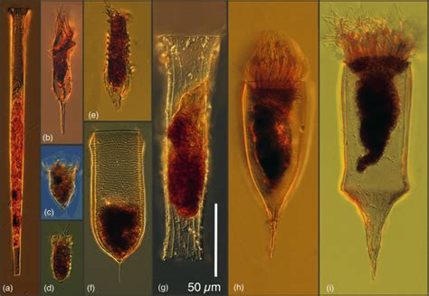  Yankiocephalus: En fascinerande Ciliat med en unikt symmetrisk form som svävar i vattenens djupa dunkel!